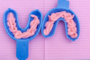 fluoride gel